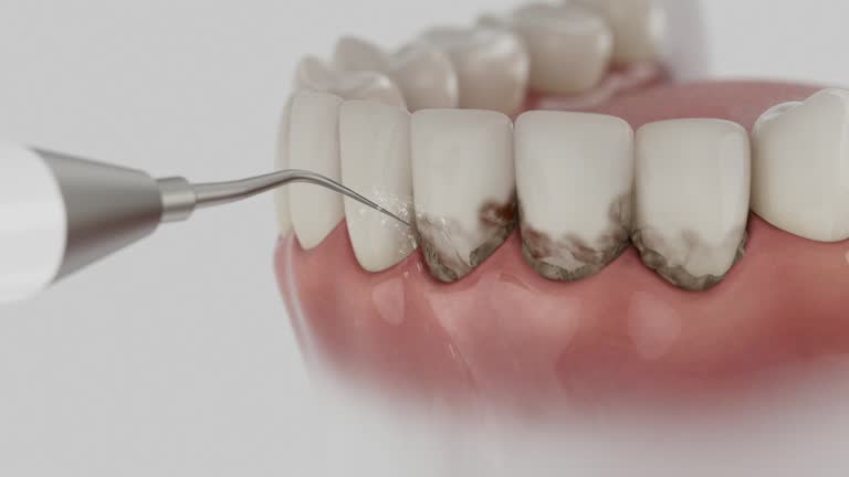 Trusted Dental Implants service in Miami, FL - Dentist Open Now